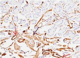 Recombinant CD146/MCAM Monoclonal Antibody (AN300301P)