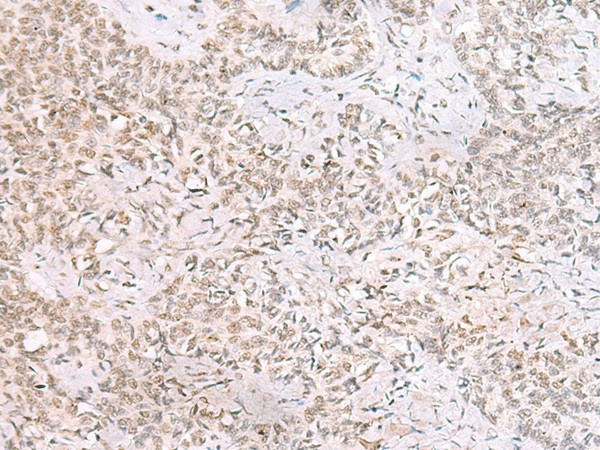 SMNDC1 Polyclonal Antibody (E-AB-18953)