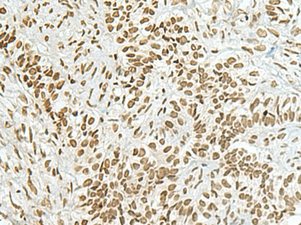 HAS1 Polyclonal Antibody (E-AB-19341)