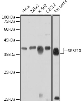 SRSF10 Polyclonal Antibody (E-AB-92697)