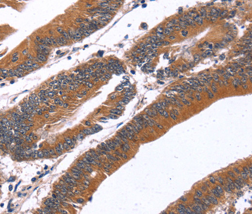 GREB1 Polyclonal Antibody (E-AB-13284)