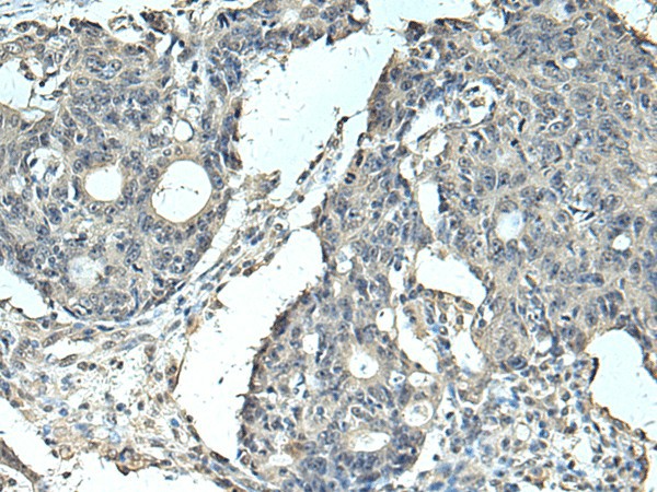 SLC35F6 Polyclonal Antibody (E-AB-19257)