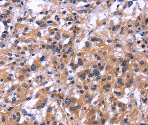 SIGLEC5 Polyclonal Antibody (E-AB-11046)