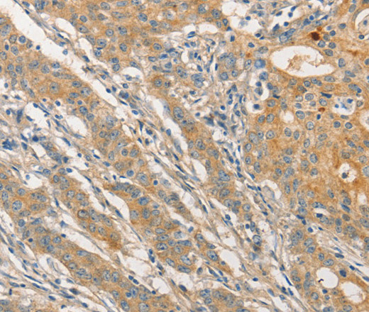STAM Polyclonal Antibody (E-AB-14656)