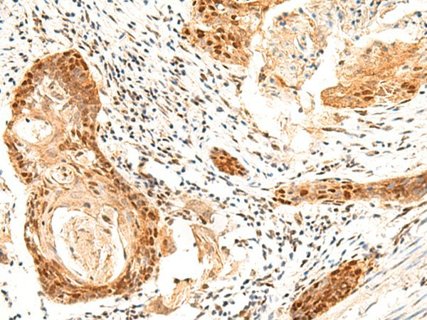 SETMAR Polyclonal Antibody (E-AB-18994)