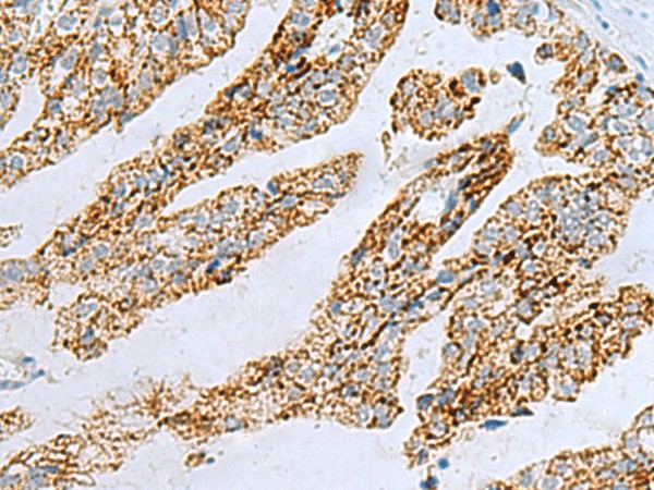 PYCR2 Polyclonal Antibody (E-AB-19230)