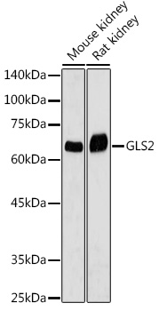 GLS2 Polyclonal Antibody (E-AB-93143)