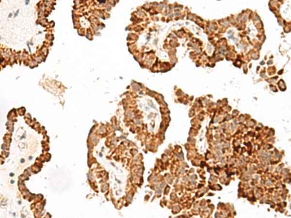 GFI1B Polyclonal Antibody (E-AB-19907)