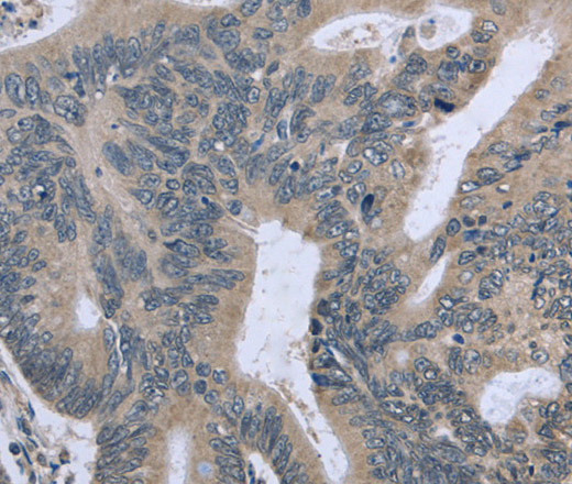 BMX Polyclonal Antibody (E-AB-15000)