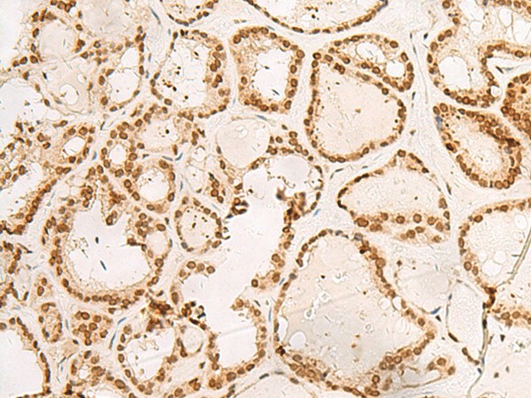 POM121 Polyclonal Antibody (E-AB-52790)