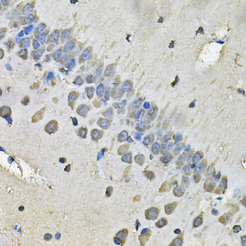 MYH1 Polyclonal Antibody (E-AB-61414)
