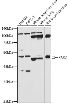 PAR2 Polyclonal Antibody (E-AB-92914)