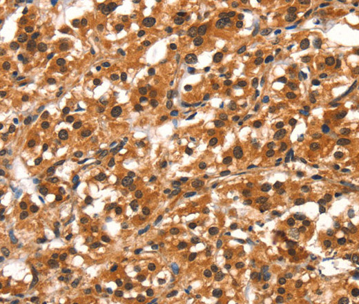 DDX4 Polyclonal Antibody (E-AB-13187)