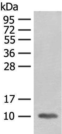 FABP4 Polyclonal Antibody (E-AB-52150)