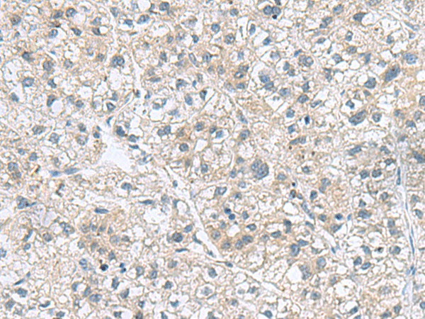 GEMIN7 Polyclonal Antibody (E-AB-53032)
