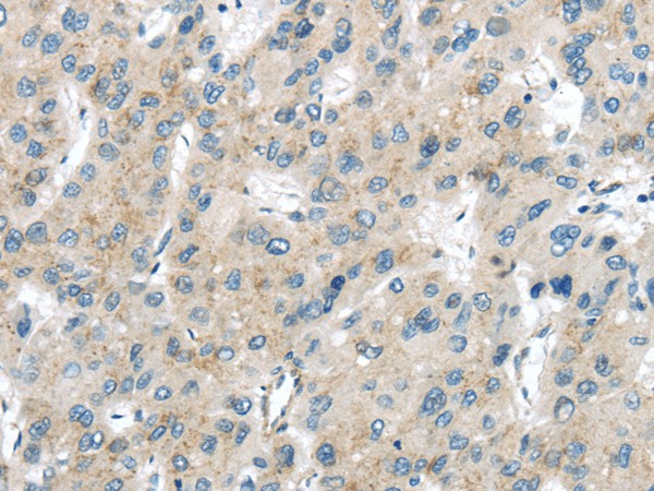 VPS26A Polyclonal Antibody (E-AB-17558)