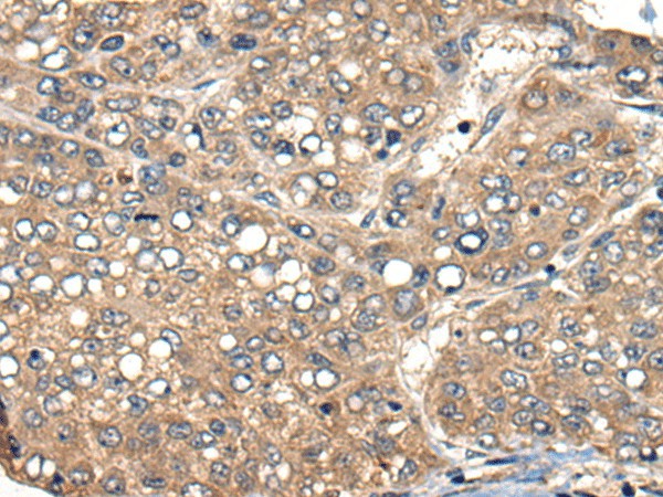 ACER1 Polyclonal Antibody (E-AB-17827)