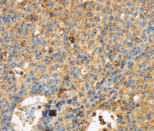 ERK 3 Polyclonal Antibody (E-AB-15626)