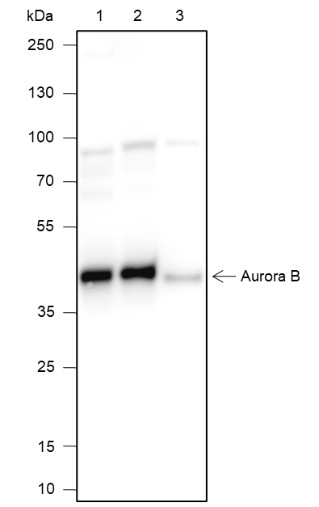 Recombinant Aurora B Monoclonal Antibody (AN301441L)