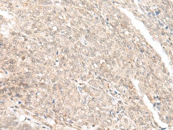 GANC Polyclonal Antibody (E-AB-17986)
