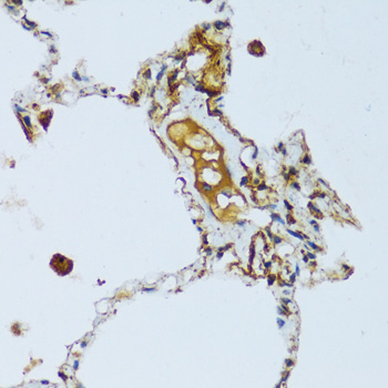 C1QC Polyclonal Antibody (E-AB-68015)