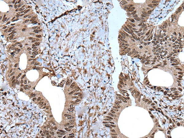ZNF787 Polyclonal Antibody (E-AB-53534)