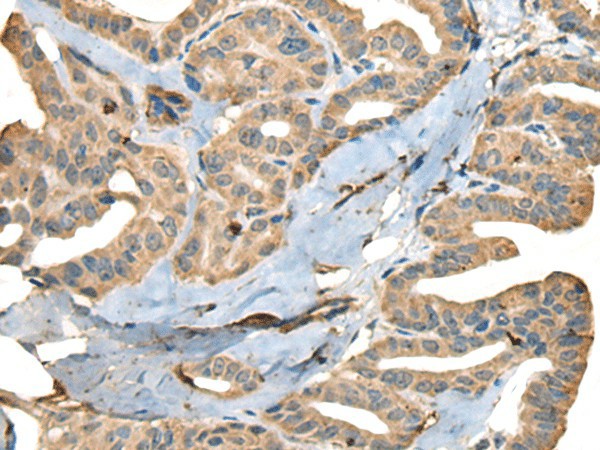 CDADC1 Polyclonal Antibody (E-AB-52528)