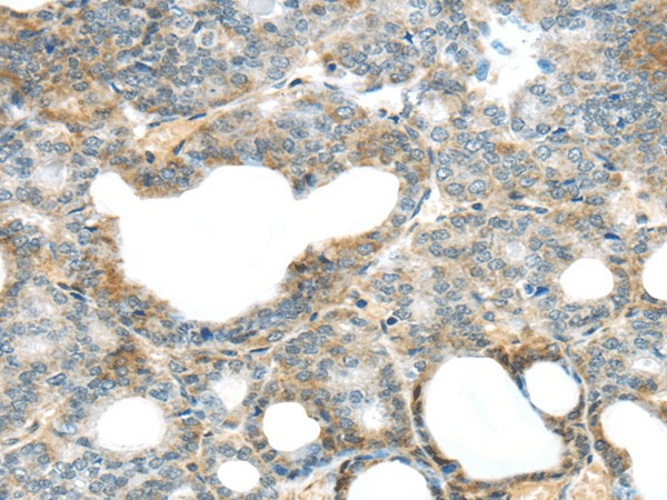 SERPINB11 Polyclonal Antibody (E-AB-17028)