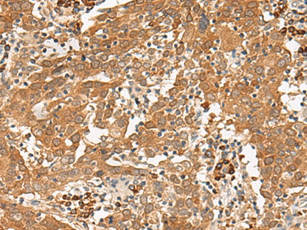 GFI1 Polyclonal Antibody (E-AB-17997)