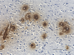 HRP anti-β-Amyloid, 1-40 Antibody (Previously Covance catalog# SIG-39146) (805407)