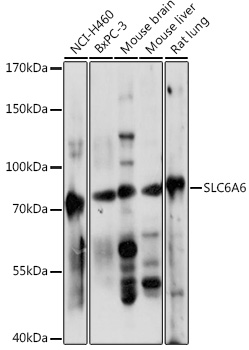 SLC6A6 Polyclonal Antibody (E-AB-90951)