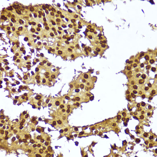 TERT Polyclonal Antibody (E-AB-66880)