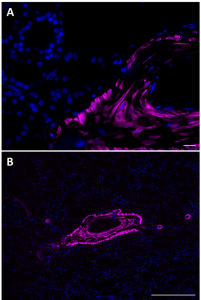 Alexa Fluor® 647 anti-α Smooth Muscle Actin Antibody (614855)
