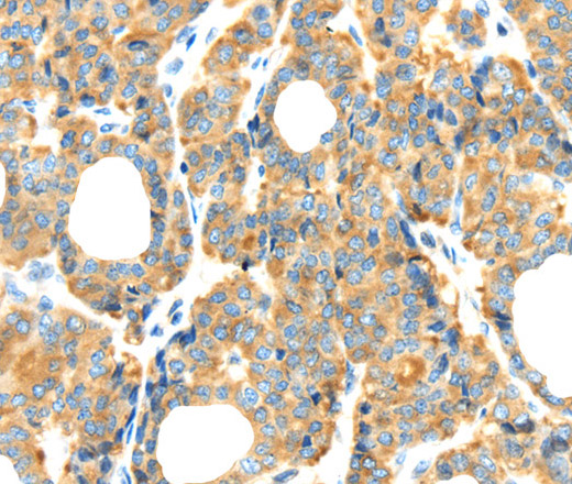 RIPK4 Polyclonal Antibody (E-AB-13568)
