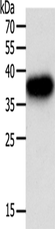 PLAUR Polyclonal Antibody (E-AB-14303)