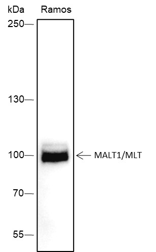 Recombinant MALT1/MLT Monoclonal Antibody (AN301595L)