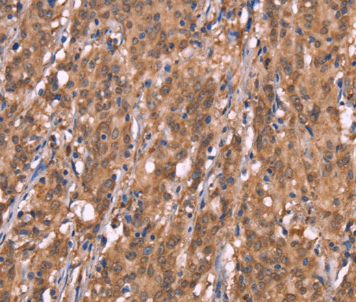 FBXO31 Polyclonal Antibody (E-AB-13238)