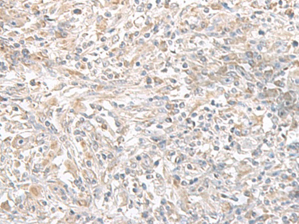 PFKM Polyclonal Antibody (E-AB-52666)