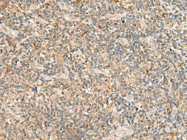 TBCK Polyclonal Antibody (E-AB-18097)