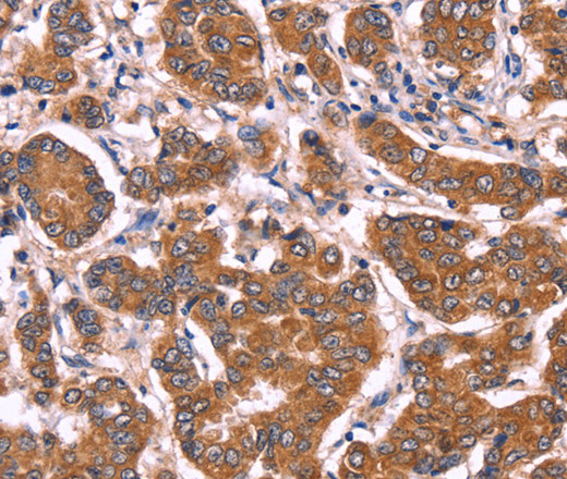 COL20A1 Polyclonal Antibody (E-AB-11093)