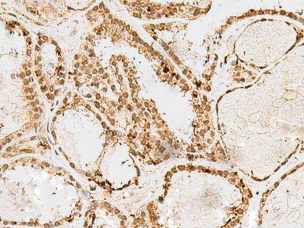 SNAPC1 Polyclonal Antibody (E-AB-52733)