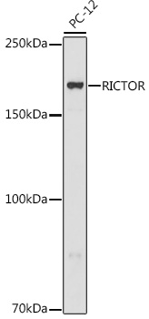 RICTOR Polyclonal Antibody (E-AB-92700)