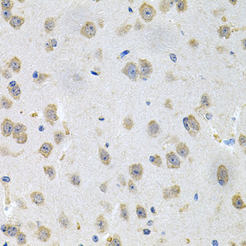 GNE Polyclonal Antibody (E-AB-63016)