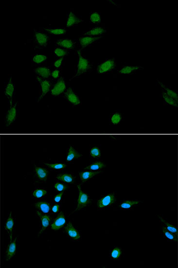 PSMA1 Polyclonal Antibody (E-AB-60710)