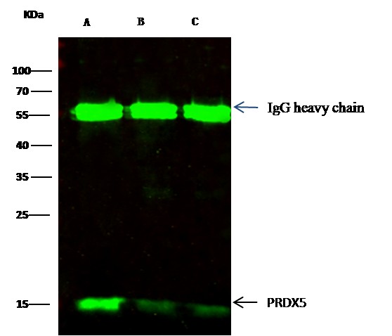Recombinant Peroxiredoxin 5/PRDX5 Monoclonal Antibody (AN300395P)