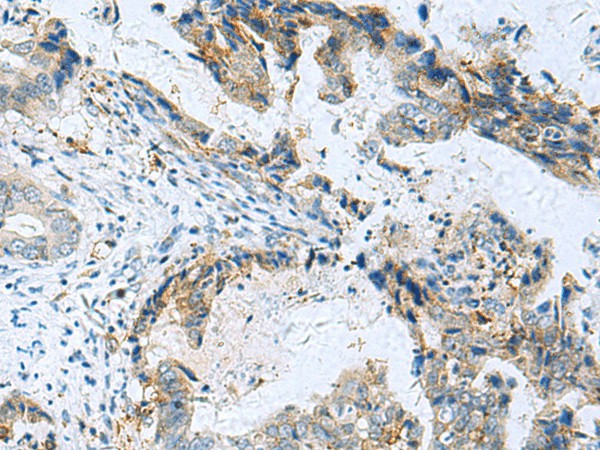RMDN2 Polyclonal Antibody (E-AB-19019)