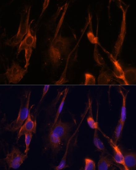 BFAR Polyclonal Antibody (E-AB-62444)