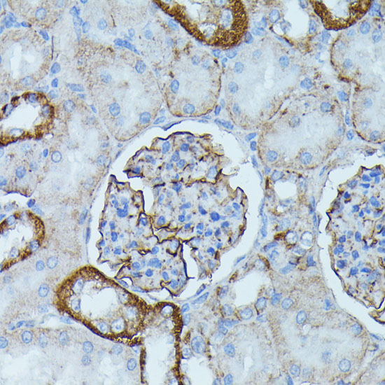PDE3A Polyclonal Antibody (E-AB-67264)