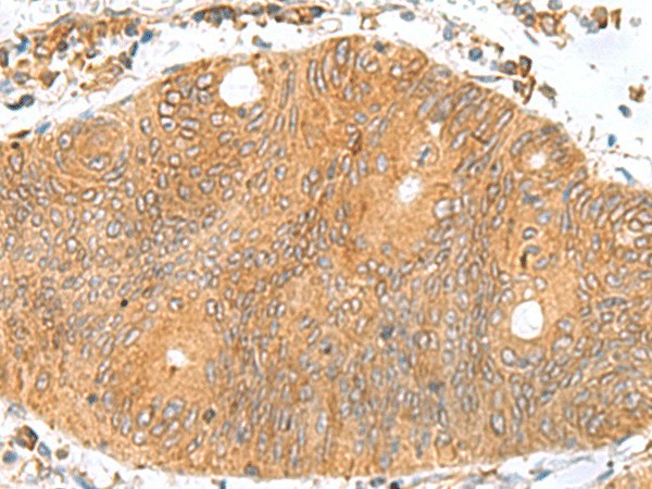 TXNDC12 Polyclonal Antibody (E-AB-19142)