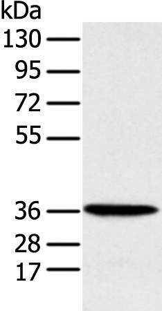 MAT2B Polyclonal Antibody (E-AB-52274)